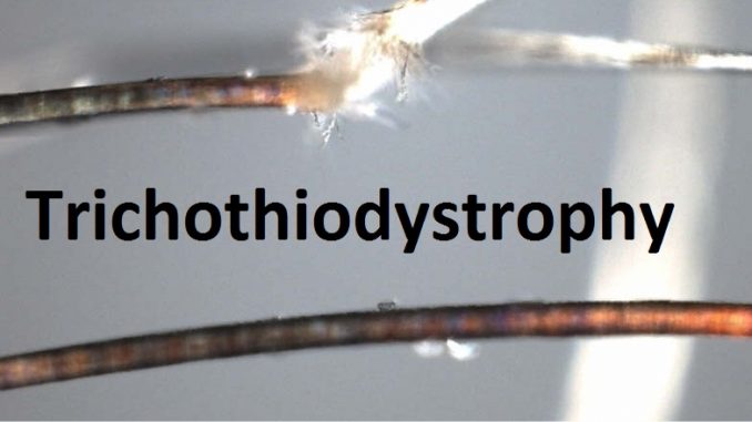 trichothiodystrophy_trichorrhexis_04_2 (1)